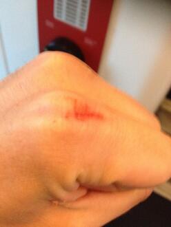 Cat_rescue_scratch
